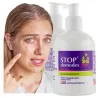 Stop Demodex  mydło do twarzy i ciała na TRĄDZIK - NUŻYCA