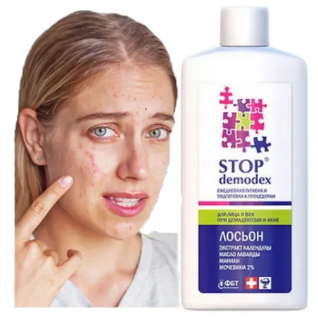 STOP Demodex Tonik do twarzy z MOCZNIKIEM 2% nużyca trądzik wągry 150 ml