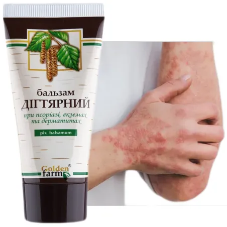 Golden Pharm krem na atopowe zapalenie skóry dla dzieci dorosłych trądzik maść AZS atopowej 50ml