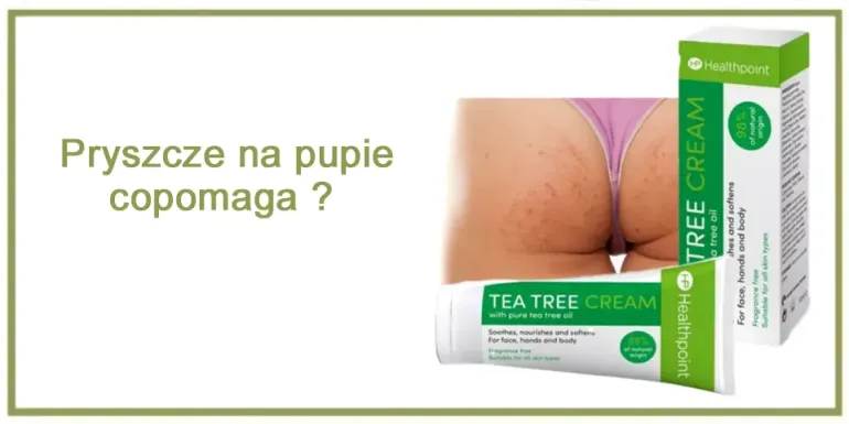 Pryszcze na pupie - co pomaga ? 