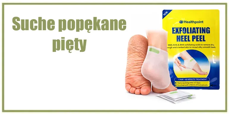 Co na suche popekane pięty ? 