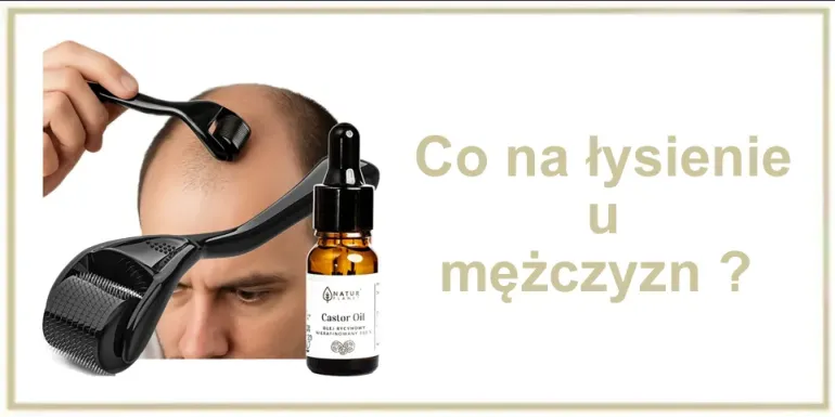 Co na łysienie u mężczyzn - wypadanie włosów - skuteczny sposób
